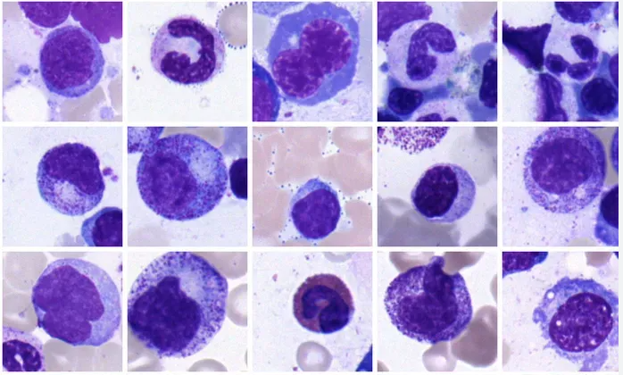 血癌 - 图像数据集