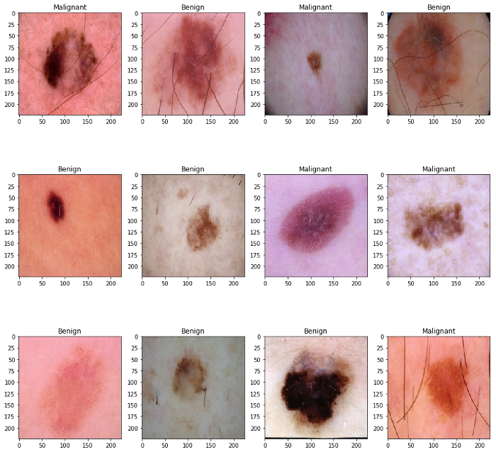 皮肤癌二元分类数据集