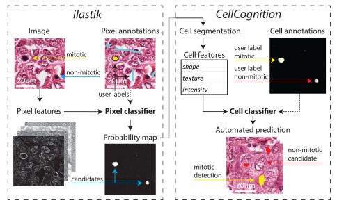 乳腺癌细胞分割