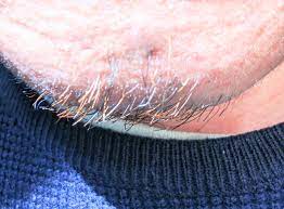 有胡子或没有胡子