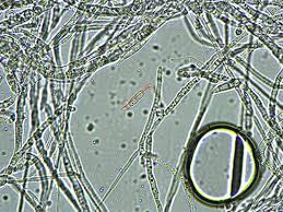 真菌的显微图像