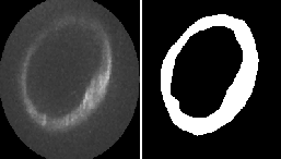 基于U-net的紫外极光观测极光椭圆形形态提取