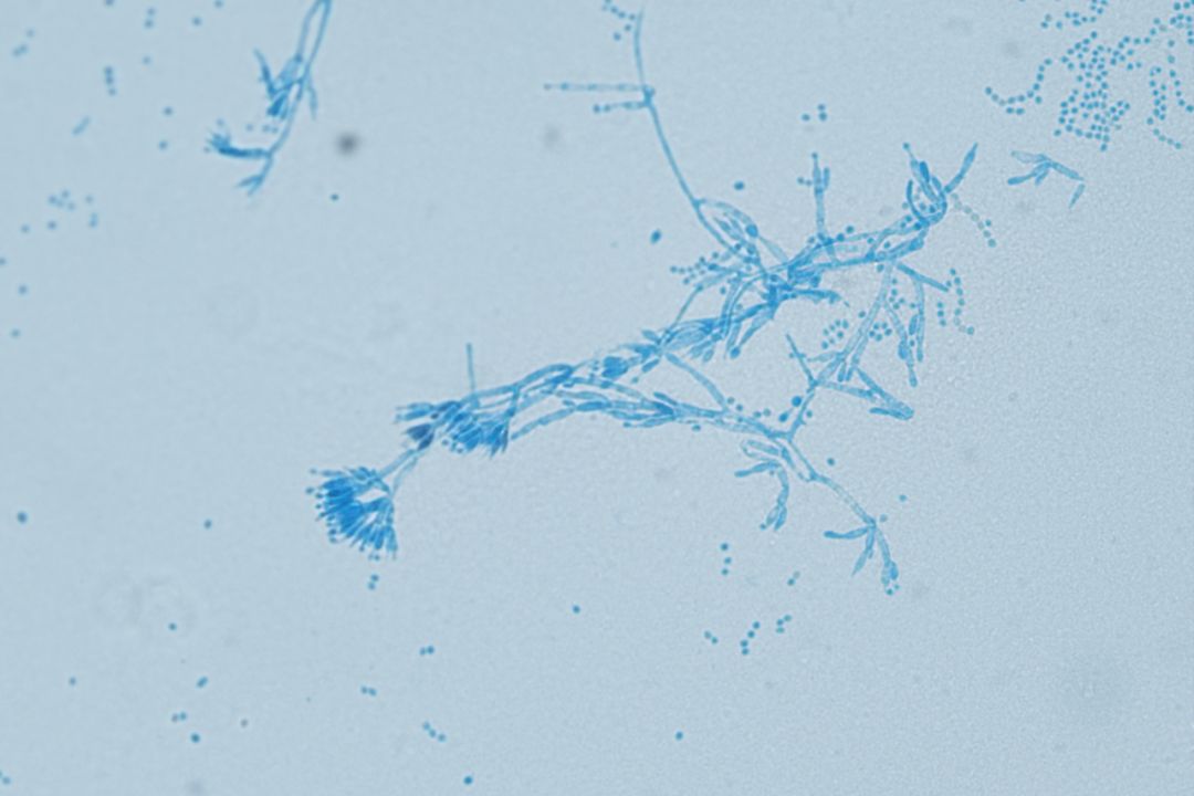 显微真菌图像 - DeFungi 数据集