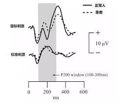 脑电图精神疾病数据集