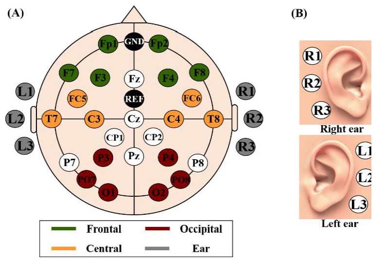 基于脑电图的实时睡眠阶段分类器