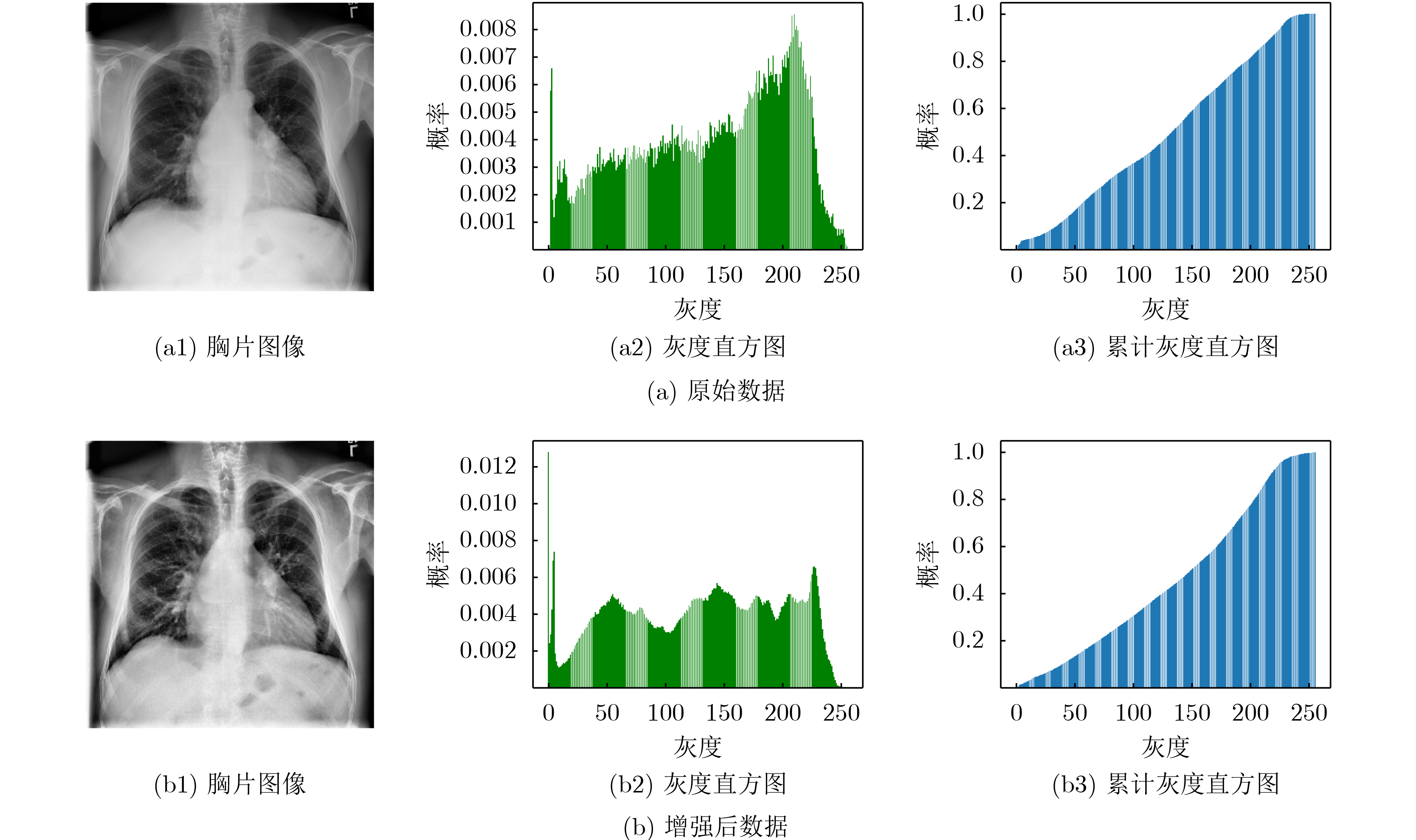 肺部疾病分类数据集（100+张图片）