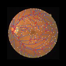 糖尿病视网膜病变数据集