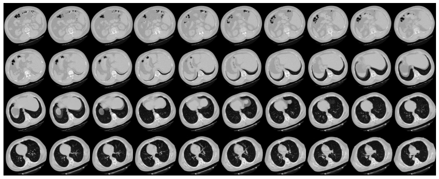 胸部 CT 扫描图像数据集