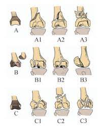 骨折分类器数据集
